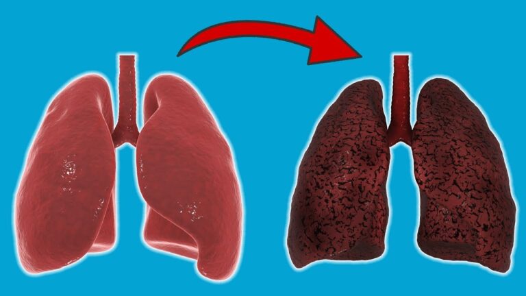 7 effetti sorprendenti del fumare ogni giorno sul tuo corpo