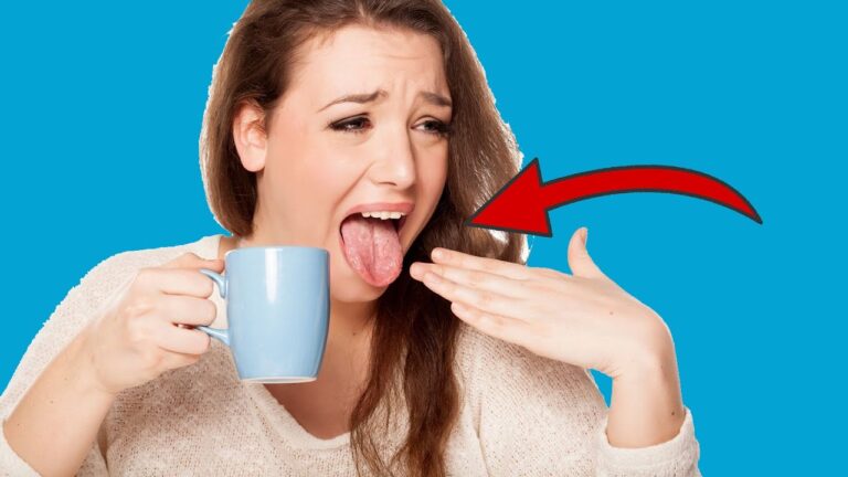 Scopri 5 cose sorprendenti che accadono dopo una scottatura alla lingua!