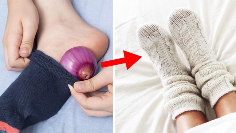 Scopri i 5 sorprendenti benefici di dormire con una cipolla nella calza!