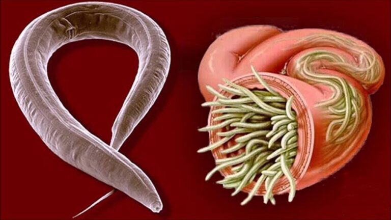 Scopri 5 rimedi naturali per eliminare i parassiti e ritrovare benessere!