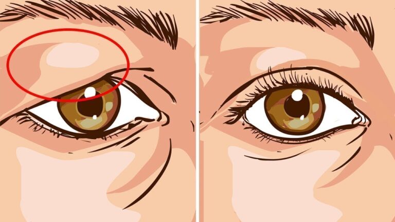 5 rimedi naturali per trattare le palpebre cadenti in modo efficace