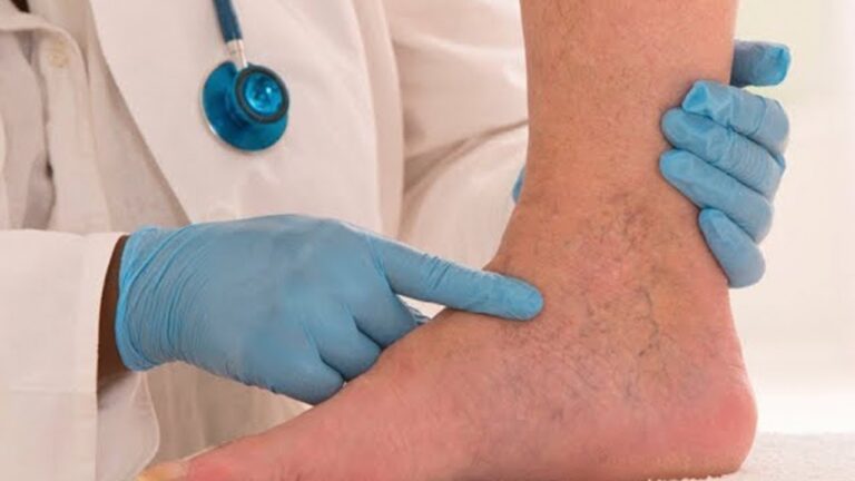 5 rimedi naturali per migliorare la circolazione del sangue e sentirti meglio!